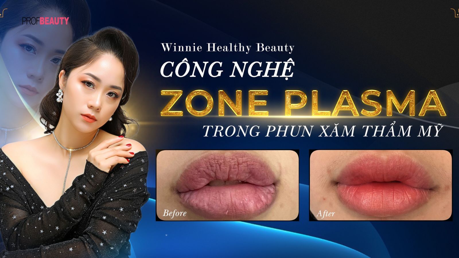 Grand master Hải Yến bật mí bí quyết trẻ hóa da đỉnh cao với công nghệ Zone Plasma tại Royal PMU Show