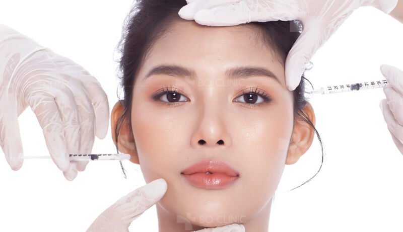 Tiêm Filler là phương pháp được phái đẹp ưa chuộng để tìm lại vẻ đẹp hồi xuân